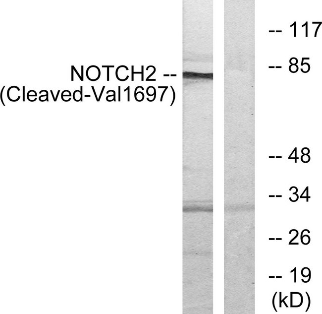 NOTCH2 Antibody - Western blot analysis of lysates from Jurkat cells, treated with etoposide 25uM 24h, using NOTCH2 (Cleaved-Val1697) Antibody. The lane on the right is blocked with the synthesized peptide.