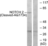NOTCH2 Antibody - Western blot of extracts from Jurkat cells, treated with etoposide 25 uM 24h, using NOTCH2 (Cleaved-Ala1734) Antibody. The lane on the right is treated with the synthesized peptide.