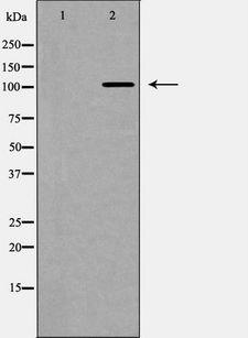 NOTCH2 Antibody - Western blot analysis of Notch 2 (Cleaved-Asp1733) expression in 293 cells extract treated with TNF-alpha. The lane on the left is treated with the antigen-specific peptide.