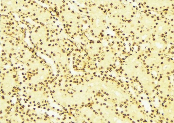 NOTCH2 Antibody - 1:100 staining mouse liver tissue by IHC-P. The sample was formaldehyde fixed and a heat mediated antigen retrieval step in citrate buffer was performed. The sample was then blocked and incubated with the antibody for 1.5 hours at 22°C. An HRP conjugated goat anti-rabbit antibody was used as the secondary.