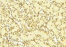NOTCH2 Antibody - 1:100 staining mouse liver tissue by IHC-P. The sample was formaldehyde fixed and a heat mediated antigen retrieval step in citrate buffer was performed. The sample was then blocked and incubated with the antibody for 1.5 hours at 22°C. An HRP conjugated goat anti-rabbit antibody was used as the secondary.