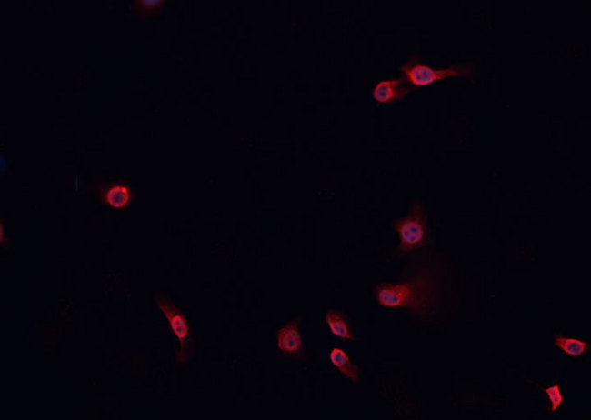 NOTCH2 Antibody - Staining HeLa cells by IF/ICC. The samples were fixed with PFA and permeabilized in 0.1% Triton X-100, then blocked in 10% serum for 45 min at 25°C. The primary antibody was diluted at 1:200 and incubated with the sample for 1 hour at 37°C. An Alexa Fluor 594 conjugated goat anti-rabbit IgG (H+L) antibody, diluted at 1/600, was used as secondary antibody.