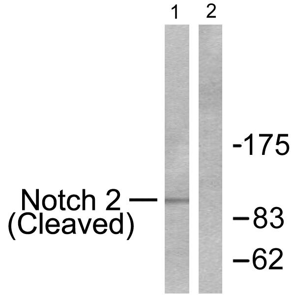 NOTCH2 Antibody - Western blot analysis of extracts from 293 cells treated with TNF-a (20ng/ml, 30mins), using Notch 2 (cleaved-Asp1733) antibody.