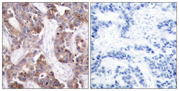 NOTCH2 Antibody - Cl-peptide - + Immunohistochemical analysis of paraffin-embedded human brain tissue using Notch 2 (cleaved-Asp1733) antibody.