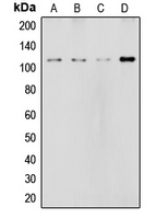 NOTCH2 Antibody - Western blot analysis of NOTCH2 expression in HeLa (A); MCF7 (B); rat liver (C); NIH3T3 (D) whole cell lysates.