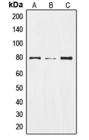 NOTCH2 Antibody - Western blot analysis of NOTCH2 expression in HepG2 colchicine-treated (A); Raw264.7 colchicine-treated (B); rat liver (C) whole cell lysates.