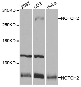NOTCH2 Antibody - Western blot analysis of extracts of various cell lines, using NOTCH2 antibody at 1:1000 dilution. The secondary antibody used was an HRP Goat Anti-Rabbit IgG (H+L) at 1:10000 dilution. Lysates were loaded 25ug per lane and 3% nonfat dry milk in TBST was used for blocking. An ECL Kit was used for detection and the exposure time was 5s.