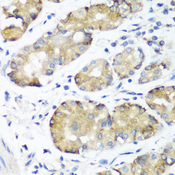 NOTCH2 Antibody - Immunohistochemistry of paraffin-embedded human stomach using NOTCH2 antibodyat dilution of 1:100 (40x lens).