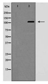 NOTCH2 Antibody - Western blot of NOTCH2 (Cleaved-Ala1734) expression in Jurkat cells, treated with etoposide