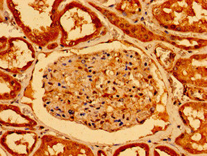 NOTCH2 Antibody - Immunohistochemistry image of paraffin-embedded human kidney tissue at a dilution of 1:100