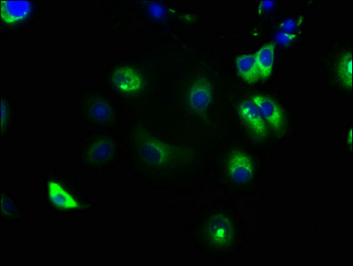 NOTCH2 Antibody - Immunofluorescence staining of MCF-7 cells with NOTCH2 Antibody at 1:133, counter-stained with DAPI. The cells were fixed in 4% formaldehyde, permeabilized using 0.2% Triton X-100 and blocked in 10% normal Goat Serum. The cells were then incubated with the antibody overnight at 4°C. The secondary antibody was Alexa Fluor 488-congugated AffiniPure Goat Anti-Rabbit IgG(H+L).