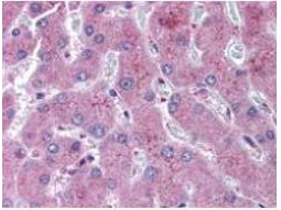 NOTCH2 Antibody - Anti-NOTCH 2 antibody was diluted 1:500 to detect NOTCH 2 in human liver tissue. Tissue was formalin fixed and paraffin embedded. No pre-treatment of sample was required. The image shows the localization of antibody as the precipitated red signal, with a hematoxylin purple nuclear counter stain.
