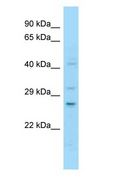 NOTCH2NL Antibody - NOTCH2NL antibody Western Blot of Jurkat.  This image was taken for the unconjugated form of this product. Other forms have not been tested.