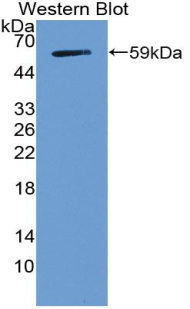 NOTCH3 Antibody - Western blot of NOTCH3 antibody. Tested with recombinant protein.