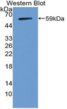 NOTCH3 Antibody - Western blot of NOTCH3 antibody. Tested with recombinant protein.