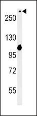 NOTCH3 Antibody - NOTCH3-Q2306 western blot of mouse NIH-3T3 cell line lysates (15 ug/lane). The NOTCH3 antibody detected the NOTCH3 protein (arrow).