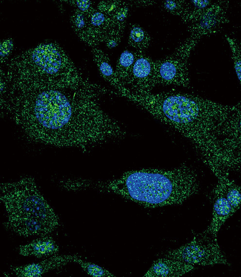 NOTCH3 Antibody - Confocal immunofluorescence of NOTCH3 Antibody with HepG2 cell followed by Alexa Fluor 488-conjugated goat anti-rabbit lgG (green). DAPI was used to stain the cell nuclear (blue).