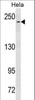 NOTCH3 Antibody - NOTCH3 Antibody (Q2306) western blot of HeLa cell line lysates (35 ug/lane). The NOTCH3 antibody detected the NOTCH3 protein (arrow).