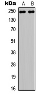 NOTCH3 Antibody - Western blot analysis of NOTCH3 expression in HEK293T (A); PC12 (B) whole cell lysates.