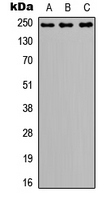 NOTCH3 Antibody - Western blot analysis of NOTCH3 expression in A549 (A); NS-1 (B); PC12 (C) whole cell lysates.