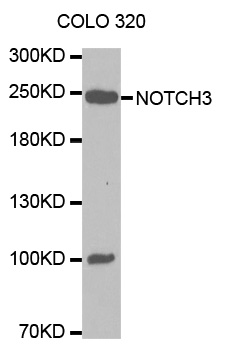 NOTCH3 Antibody - Western blot analysis of extracts of COLO 320 cells lines, using NOTCH3 antibody.
