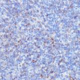 NOTCH3 Antibody - Immunohistochemistry of paraffin-embedded Mouse spleen using NOTCH3 Polyclonal Antibody at dilution of 1:100 (40x lens).
