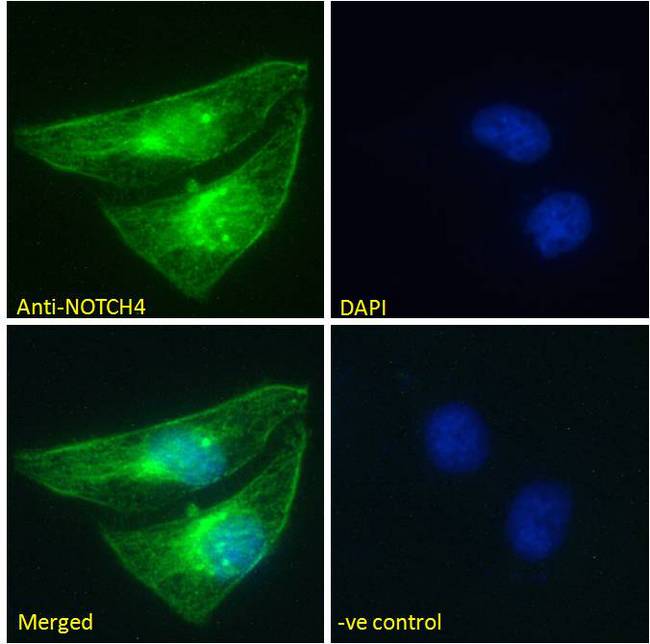NOTCH4 Antibody - NOTCH4 antibody immunofluorescence analysis of paraformaldehyde fixed HeLa cells, permeabilized with 0.15% Triton. Primary incubation 1hr (10ug/ml) followed by Alexa Fluor 488 secondary antibody (2ug/ml), showing membrane and nuclear staining. The nuclear stain is DAPI (blue). Negative control: Unimmunized goat IgG (10ug/ml) followed by Alexa Fluor 488 secondary antibody (2ug/ml).