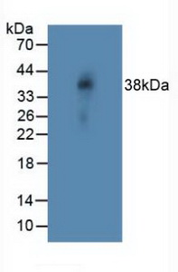 NOTCH4 Antibody - Western Blot; Sample: Rat Vein Tissue.