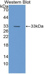 NOTCH4 Antibody - Western blot of recombinant NOTCH4.