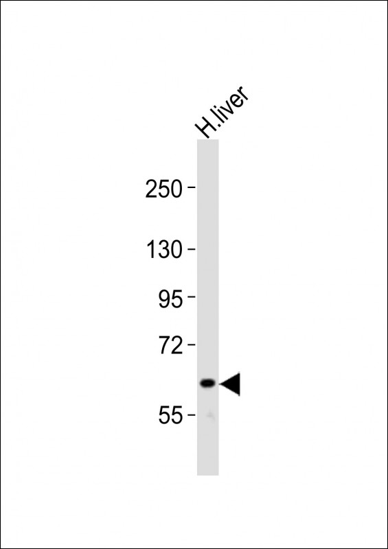 NOTCH4 Antibody - Anti-NOTCH4 Antibody at 1:2000 dilution + human liver lysates Lysates/proteins at 20 ug per lane. Secondary Goat Anti-Rabbit IgG, (H+L), Peroxidase conjugated at 1/10000 dilution Predicted band size : 210 kDa Blocking/Dilution buffer: 5% NFDM/TBST.