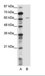 NOTCH4 Antibody - A: Marker, B: Jurkat Cell Lysate.  This image was taken for the unconjugated form of this product. Other forms have not been tested.