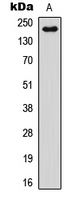 NOTCH4 Antibody - Western blot analysis of NOTCH4 expression in HEK293T (A) whole cell lysates.
