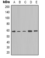 NOTCH4 Antibody - Western blot analysis of NOTCH4 expression in A549 (A); K562 (B); HeLa (C); mouse brain (D); NIH3T3 (E) whole cell lysates.