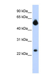 NOTCH4 Antibody - NOTCH4 antibody Western Blot analysis of HepG2 cell lysate.  This image was taken for the unconjugated form of this product. Other forms have not been tested.