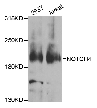 NOTCH4 Antibody - Western blot analysis of extracts of various cell lines.