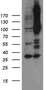 NOTCH4 Antibody - HEK293T cells were transfected with the pCMV6-ENTRY control. (Left lane) or pCMV6-ENTRY NOTCH4. (Right lane) cDNA for 48 hrs and lysed