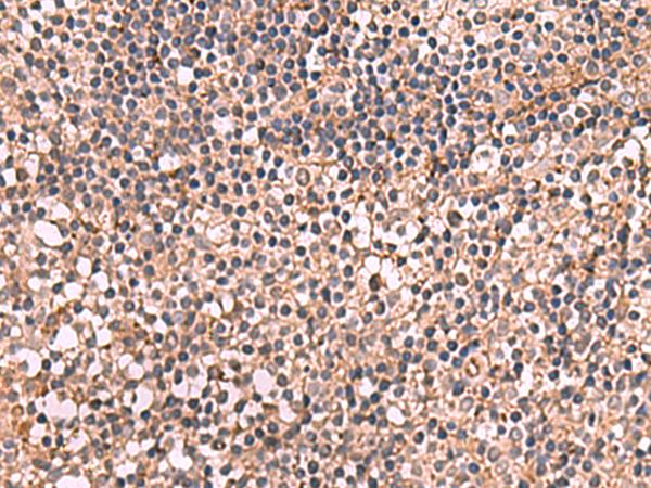NOTCH4 Antibody - Immunohistochemistry of paraffin-embedded Human tonsil tissue  using NOTCH4 Polyclonal Antibody at dilution of 1:30(×200)