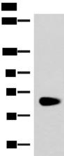 NOTCH4 Antibody - Western blot analysis of Human left kidney paracancerous tissue lysate  using NOTCH4 Polyclonal Antibody at dilution of 1:800