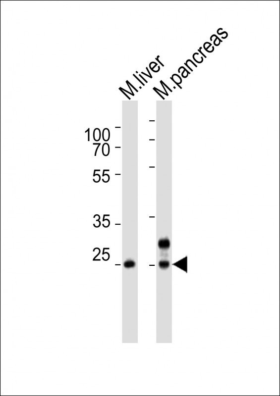 NOTO Antibody - Western blot of lysates from mouse liver, mouse pancreas tissue lysate (from left to right), using Noto antibody diluted at 1:4000 at each lane. A goat anti-rabbit IgG H&L (HRP) at 1:10000 dilution was used as the secondary antibody. Lysates at 20 ug per lane.