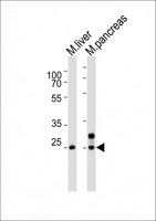 NOTO Antibody - Western blot of lysates from mouse liver, mouse pancreas tissue lysate (from left to right), using Noto antibody diluted at 1:4000 at each lane. A goat anti-rabbit IgG H&L (HRP) at 1:10000 dilution was used as the secondary antibody. Lysates at 20 ug per lane.