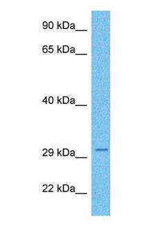 NOTO Antibody - Western blot of NOTO Antibody with human Ovary Tumor lysate.  This image was taken for the unconjugated form of this product. Other forms have not been tested.