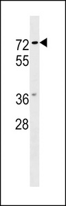 NOTUM Antibody - NOTUM Antibody western blot of MCF-7 cell line lysates (35 ug/lane). The NOTUM antibody detected the NOTUM protein (arrow).