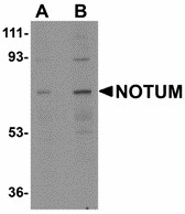 NOTUM Antibody - Western blot of NOTUM in human kidney tissue lysate with NOTUM antibody at (A) 0.5 and (B) 1 ug/ml. Below: Immunohistochemistry of NOTUM in human brain tissue with NOTUM antibody at 2.5 ug/ml.