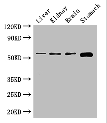 NOTUM Antibody - Positive WB detected in:Mouse liver tissue,Mouse kidney tissue,Mouse brain tissue,Mouse stomach tissue;All lanes: NOTUM antibody at 2.7ug/ml;Secondary;Goat polyclonal to rabbit IgG at 1/50000 dilution;Predicted band size: 56 kDa;Observed band size: 56 kDa;