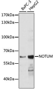 NOTUM Antibody - Western blot analysis of extracts of various cell lines using NOTUM Polyclonal Antibody at dilution of 1:1000.