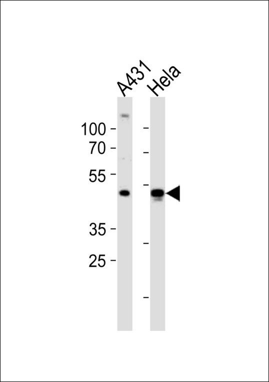 NOVA1 Antibody - Western blot of lysates from A431, HeLa cell line (from left to right) with NOVA1 Antibody. Antibody was diluted at 1:1000 at each lane. A goat anti-rabbit IgG H&L (HRP) at 1:10000 dilution was used as the secondary antibody. Lysates at 20 ug per lane.