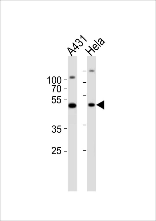 NOVA1 Antibody - Western blot of lysates from A431, HeLa cell line (from left to right) with NOVA1 Antibody. Antibody was diluted at 1:1000 at each lane. A goat anti-rabbit IgG H&L (HRP) at 1:10000 dilution was used as the secondary antibody. Lysates at 20 ug per lane.