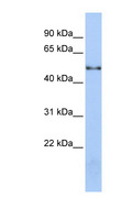 NOVA1 Antibody - NOVA1 antibody Western blot of Jurkat lysate. This image was taken for the unconjugated form of this product. Other forms have not been tested.