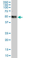 NOVA1 Antibody - NOVA1 monoclonal antibody (M10), clone 5D9. Western blot of NOVA1 expression in PC-12.