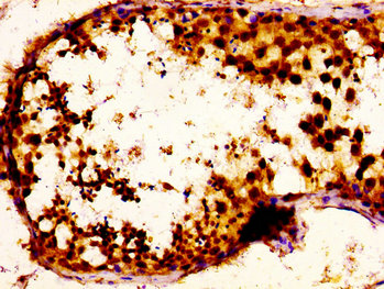 NOVA1 Antibody - Immunohistochemistry image at a dilution of 1:100 and staining in paraffin-embedded human testis tissue performed on a Leica BondTM system. After dewaxing and hydration, antigen retrieval was mediated by high pressure in a citrate buffer (pH 6.0) . Section was blocked with 10% normal goat serum 30min at RT. Then primary antibody (1% BSA) was incubated at 4 °C overnight. The primary is detected by a biotinylated secondary antibody and visualized using an HRP conjugated SP system.